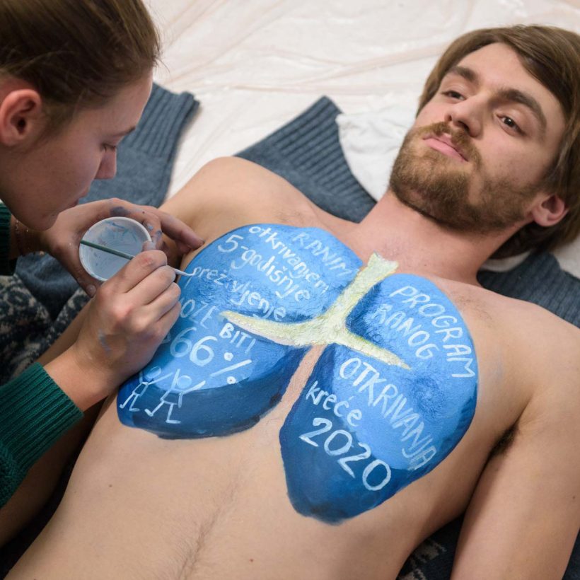 Govorimo o raku pluća (36 of 74)