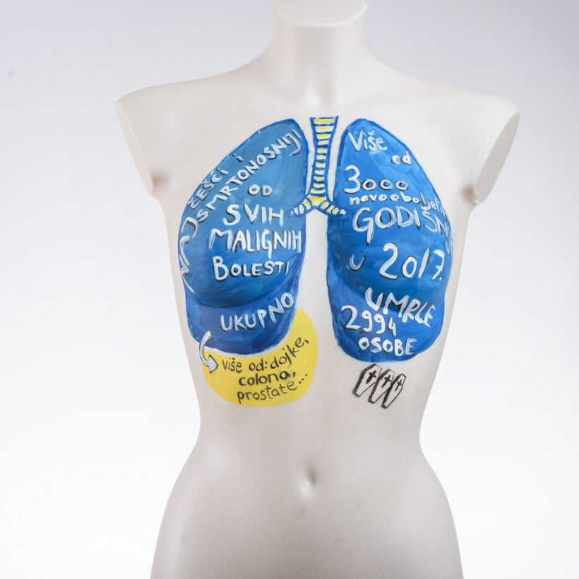 Govorimo o raku pluća (38 of 74)