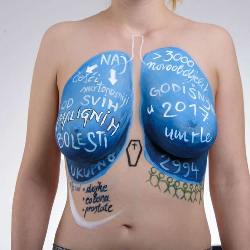 Govorimo o raku pluća (40 of 74)